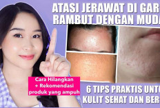 Atasi Jerawat di Garis Rambut dengan Mudah, 6 Tips Praktis untuk Kulit Sehat dan Bersih, Auto Tampil Mempesona