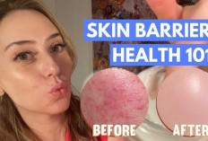 Rahasia Kulit Sehat! 5 Kandungan Skincare Terbaik untuk Memulihkan Skin Barrier, Cek Sebelum Beli Ya Sist!