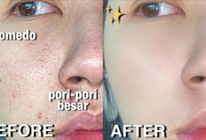 Wajah Glass Skin Impian Bukan Mustahil! 8 Langkah Efektif Mengecilkan Pori-Pori Besar dalam Hitungan Hari