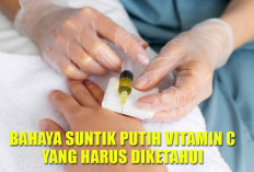 Hasil Instan, Efek Jangka Panjang: Bahaya Suntik Putih Vitamin C yang Harus Diketahui