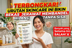 TERBONGKAR! Urutan Skincare Ini Bikin Bekas Jerawat Membandel Hilang Tanpa Sisa, Banyak yang Selama Ini SALAH