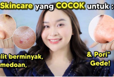 Rekomendasi Produk Skincare yang Cocok untuk Kulit Berminyak, Komedoan & Pori-pori Gede, Jangan Salah Beli Ya 