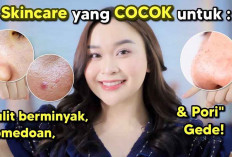 Dari Sabun Wajah hingga Serum: 7 Produk Skincare Terbaik untuk Kulit Berminyak dan Berjerawat