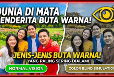 Dunia di Mata Penderita Buta Warna! Ini Jenis-jenis Buta Warna yang Paling Sering Dialami