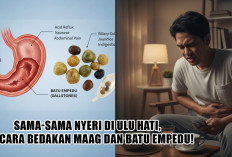 Sama sama Nyeri di Ulu Hati, Ini Cara Bedakan Maag dan Batu Empedu!