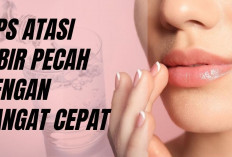 Jangan Biarkan Bibir Pecah Mengganggu Ibadah! Simak 5 Tips Praktis Mengatasi Bibir Kering Saat Puasa
