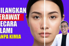 Terbukti Ampuh! 4 Rahasia Menghilangkan Jerawat Secara Alami: Wajah Bersih, Mulus, dan Glowing Tanpa Obat Kimi