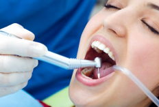 Hati hati, 4 Penyebab Gigi Berlubang Jangan Dianggap Remeh! Nomor 2 Tak Dapat Dihindari