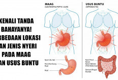 Kenali Tanda Bahayanya! Perbedaan Lokasi dan Jenis Nyeri pada Maag dan Usus Buntu