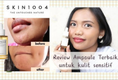 6 Rekomendasi Serum Ampoule Ter The Best, Atasi Berbagai Masalah Kulit, Bikin Wajah Glowing Bak Idol Korea