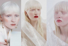 Kisah Inspiratif Model Albino Nastya Dzitkova yang Dijuluki 'Malaikat Cantik'