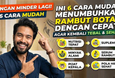 Jangan Minder Lagi! Ini 6 Cara Mudah Menumbuhkan Rambut Botak dengan Cepat agar Kembali Tebal dan Sehat