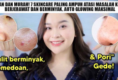 Aman dan Murah! 7 Skincare Paling Ampuh Atasi Masalah Kulit Berjerawat dan Berminyak, Auto Glowing Maksimal