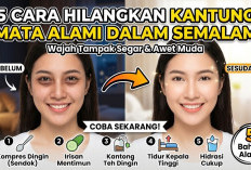 5 Cara Menghilangkan Kantung Mata Secara Alami dalam Semalam Agar Wajah Tampak Segar dan Awet Muda