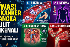 Sering Luput dari Perhatian! 4 Jenis Kanker Langka Ini Perlu Dikenali agar Gejalanya Tidak Terabaikan