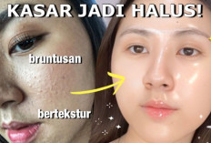 Rekomendasi Produk Skincare yang Ampuh Hilangkan Bekas Jerawat Bandel, Harganya Gak Bikin Kantong Bolong