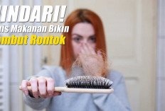 Hati-Hati Bisa Jadi Botak! Hindari 7 Jenis Makanan Ini Jika Tak Ingin Rambut Rontok, Nomor 3 Paling Favorit