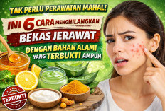 Tak Perlu Perawatan Mahal! Ini 6 Cara Menghilangkan Bekas Jerawat dengan Bahan Alami yang Terbukti Ampuh