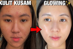 5 Cara Ampuh untuk Kulit Cerah dan Glowing: Rahasia Kulit Sehat yang Bisa Kamu Lakukan di Rumah!