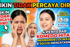 Bikin Tidak Percaya Diri! Ini 4 Penyebab Komedo Hitam Membandel di Wajah dan Solusi Mengatasinya
