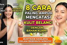 8 Cara Paling Ampuh Mengatasi Kulit Belang dengan Bahan Alami, Buktikan Sendiri Hasilnya dalam Beberapa Minggu