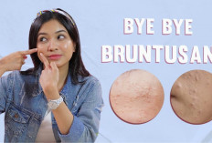 7 Rekomendasi Produk Skincare Untuk Menghilangkan Bruntusan Pada Wajah!