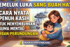 Memeluk Luka Sang Buah Hati! 5 Cara Nyata dan Penuh Kasih untuk Menyembuhkan Trauma Mental Korban Perundungan