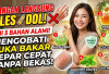 Jangan Langsung Oles Odol! Ini 5 Bahan Alami untuk Mengobati Luka Bakar Secara Cepat Tanpa Meninggalkan Bekas