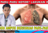 Terbukti Efektif! 7 Cara Alami Membersihkan Lendir di Paru-Paru Tanpa Obat Kimia