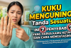 Kuku Menguning Bisa Jadi Tanda Sesuatu! Ini 7 Penyebab yang Harus Kamu Ketahui dan Cara Mengatasinya